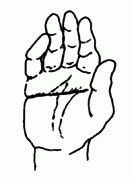 kisujj